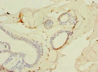 SLC25A4 Antibody