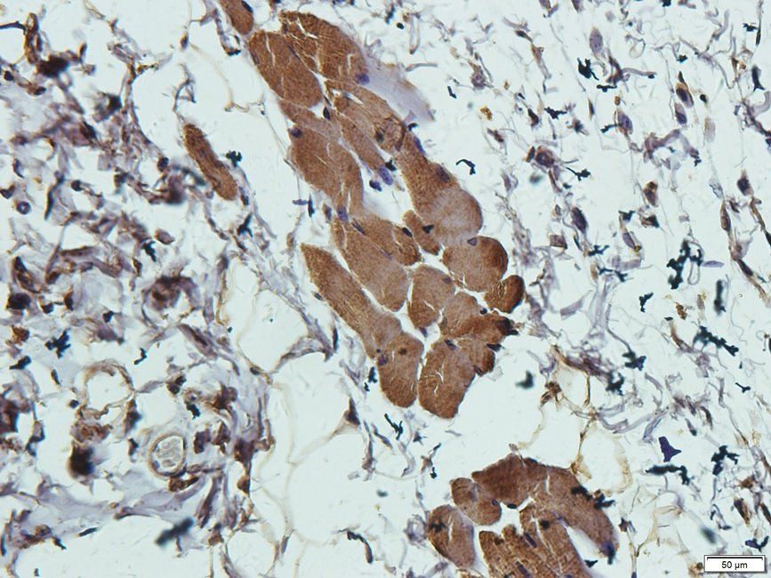 Slc28a3 Rabbit Polyclonal Antibody