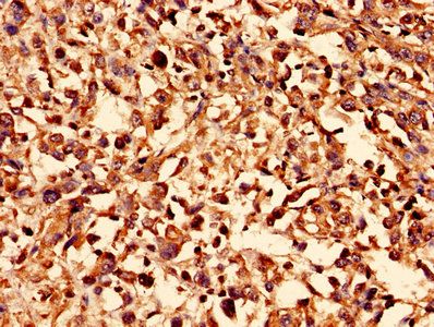 SLC2A4 Antibody