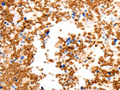 SLC2A5 Antibody