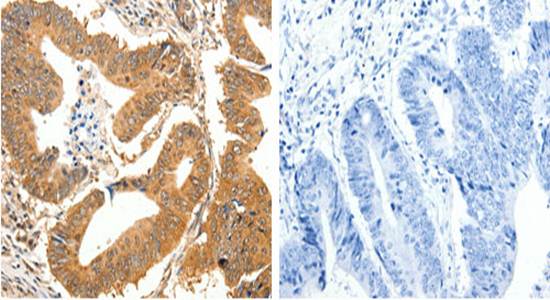 SLC32A1 Rabbit Polyclonal Antibody