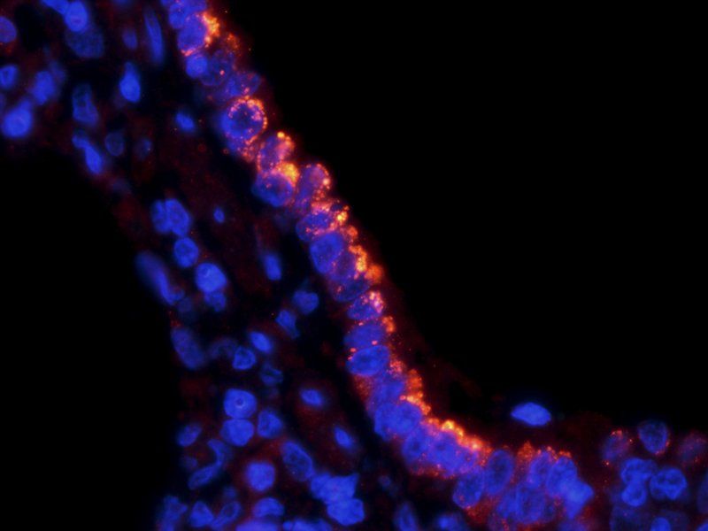 SLC34A2 Rabbit Polyclonal Antibody