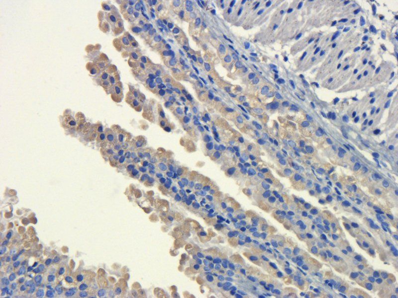 SLC34A2 Rabbit Polyclonal Antibody