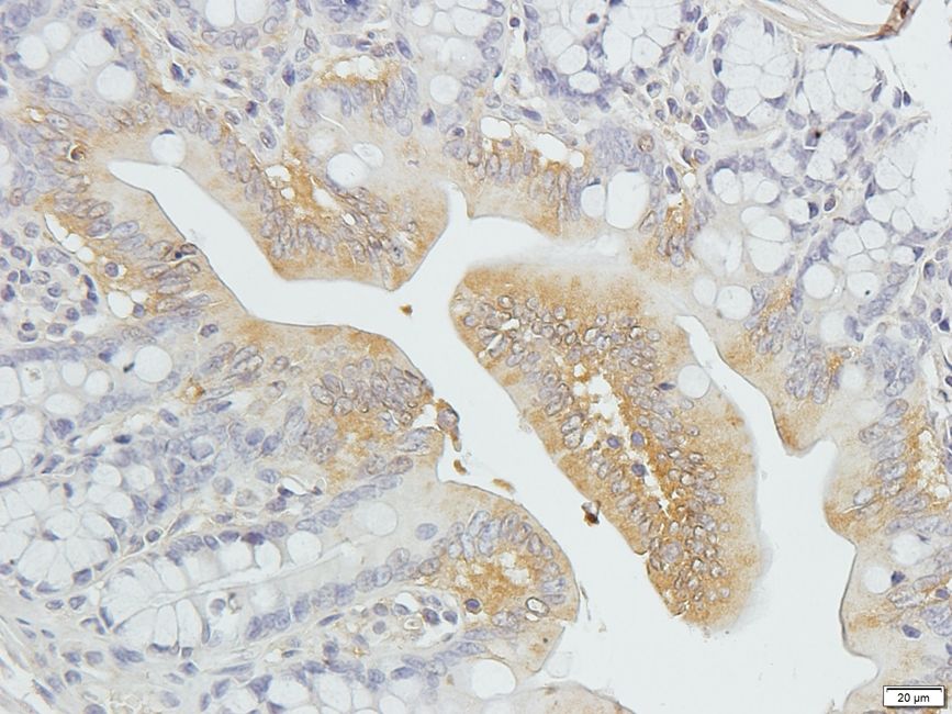 SLC40A1 Rabbit Polyclonal Antibody