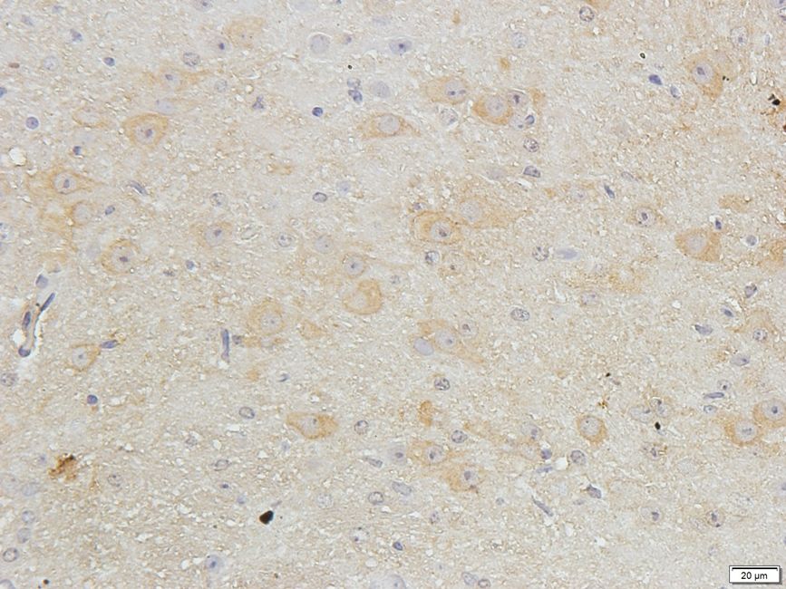 SLC40A1 Rabbit Polyclonal Antibody
