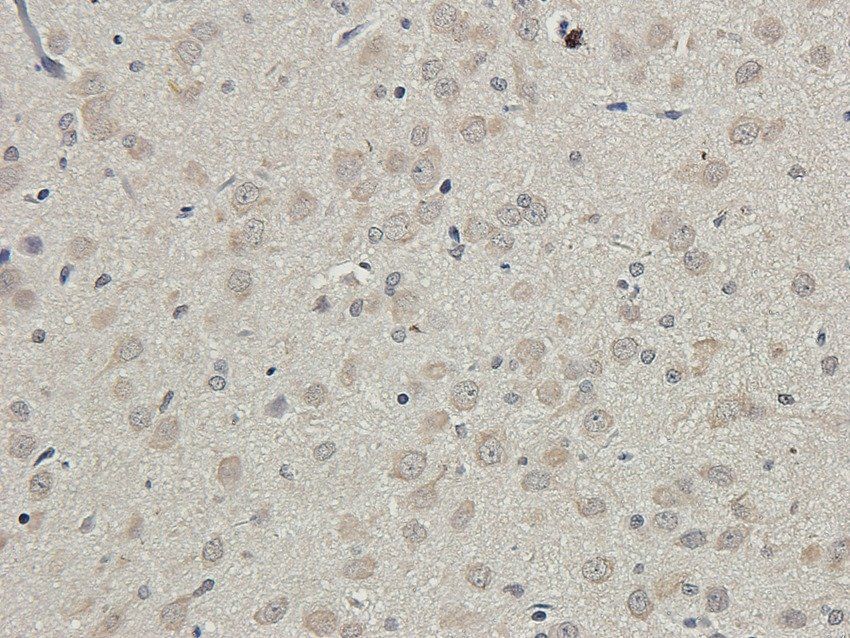SLC6A5 Rabbit Polyclonal Antibody