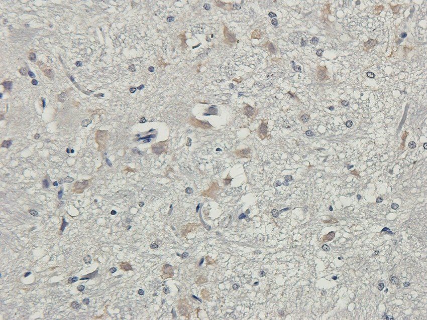 SLC6A5 Rabbit Polyclonal Antibody