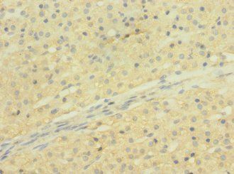 SLCO2B1 Antibody