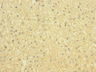SLCO2B1 Antibody