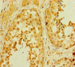 SMAD2 Antibody