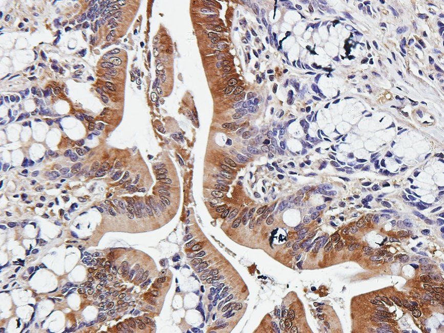 SMAD2 Rabbit Polyclonal Antibody