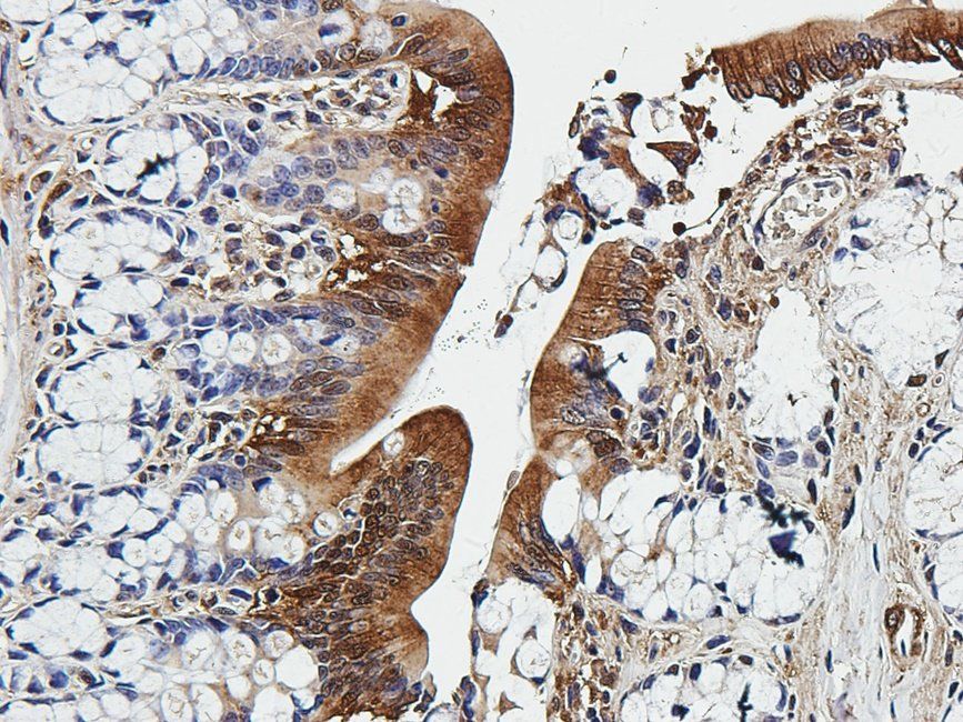 SMAD2 Rabbit Polyclonal Antibody