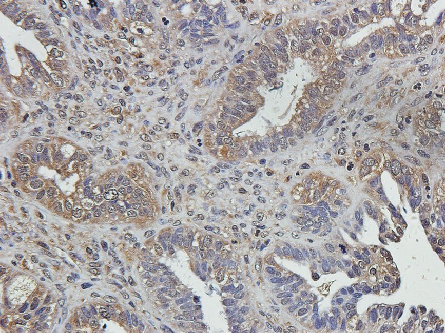 SMAD2 Rabbit Polyclonal Antibody