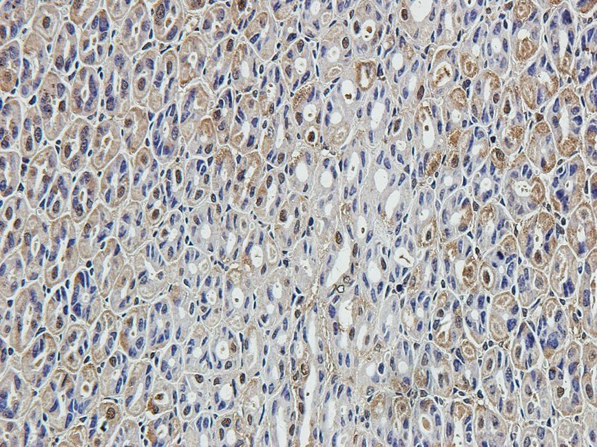 SMAD2 Rabbit Polyclonal Antibody