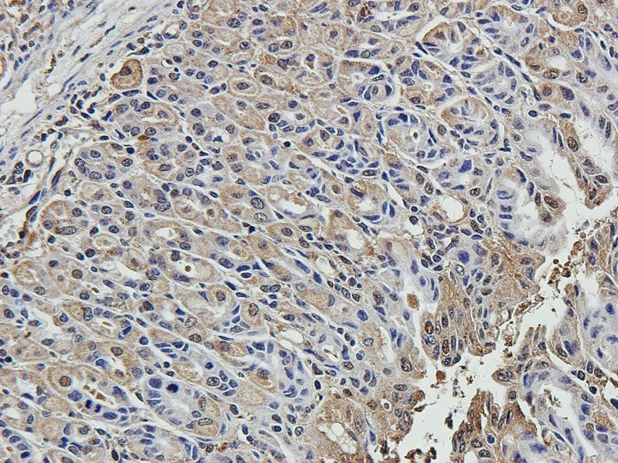 SMAD2 Rabbit Polyclonal Antibody