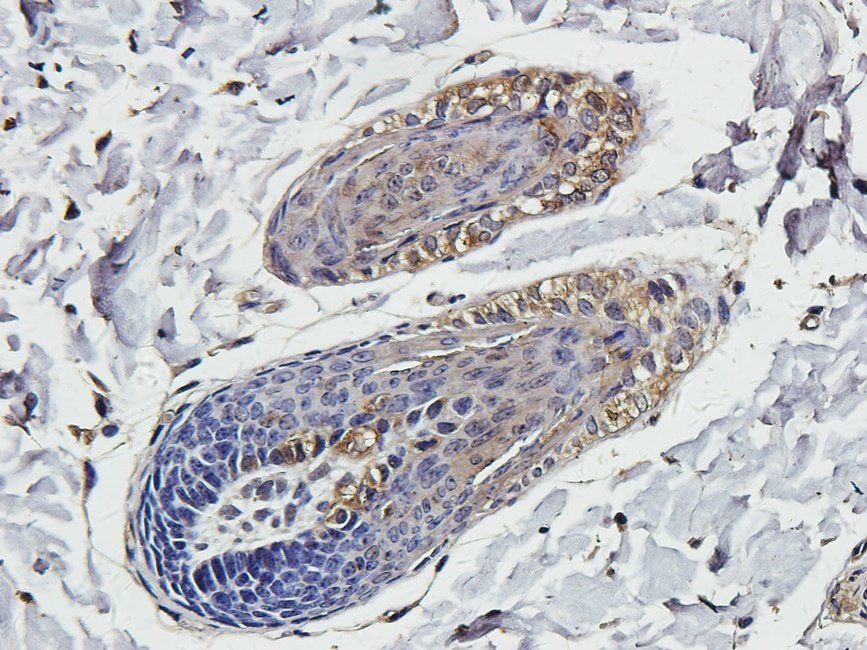 SMAD2 Rabbit Polyclonal Antibody