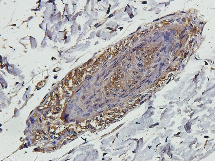 SMAD2 Rabbit Polyclonal Antibody