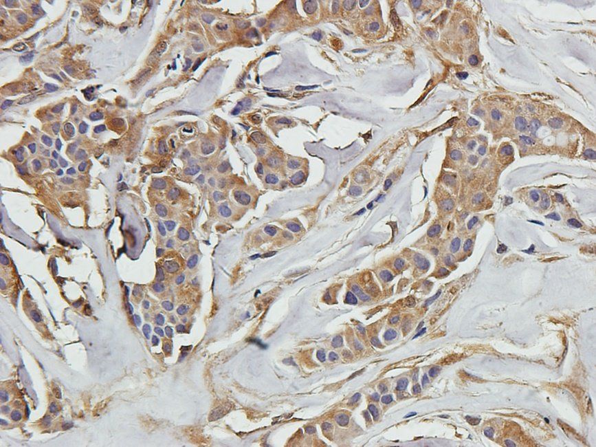 SMAD2 Rabbit Polyclonal Antibody