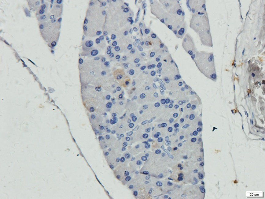 SMAD2 Rabbit Polyclonal Antibody