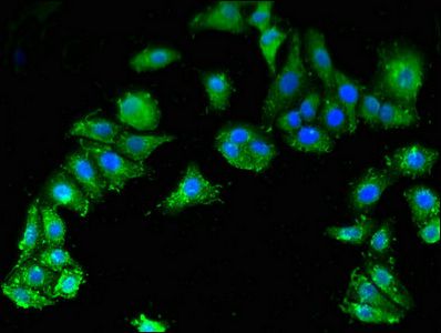 SMN1 Antibody