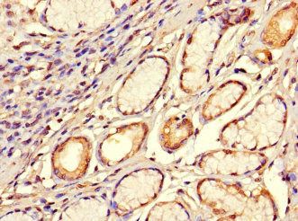 SMOC1 Antibody