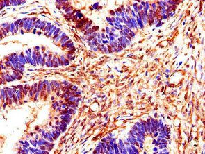 SMS Antibody