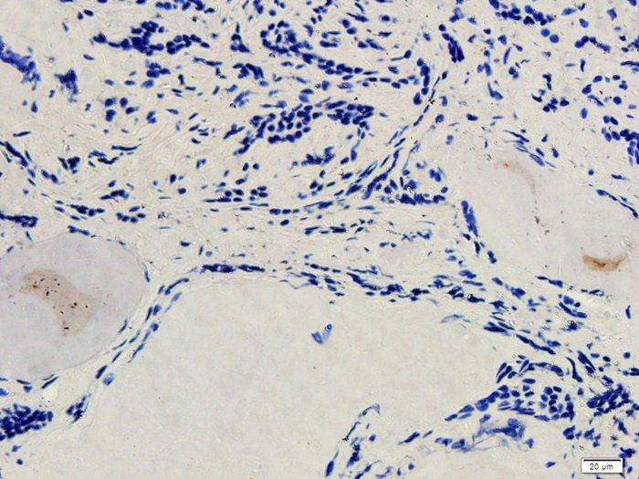 SNAIL Rabbit Polyclonal Antibody