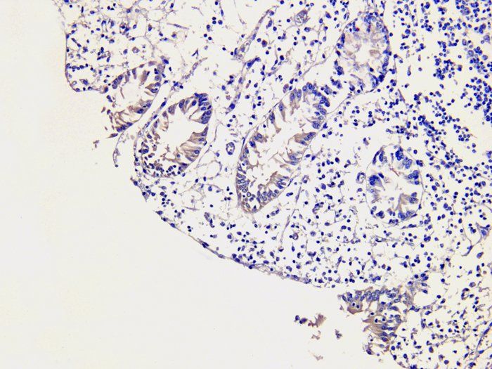 SNAIL Rabbit Polyclonal Antibody