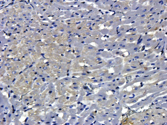 SNAIL Rabbit Polyclonal Antibody