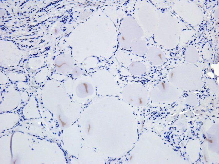 SNAIL Rabbit Polyclonal Antibody