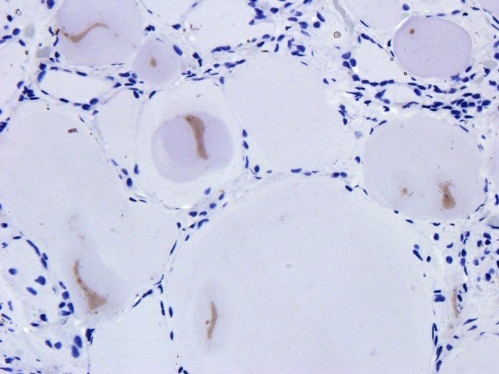 SNAIL Rabbit Polyclonal Antibody