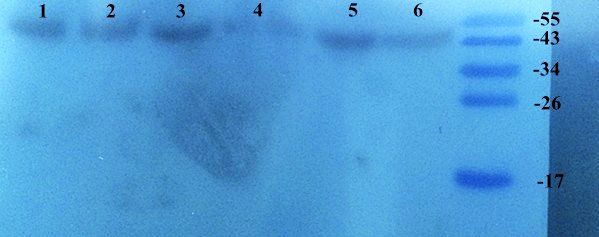 SNAIL Rabbit Polyclonal Antibody