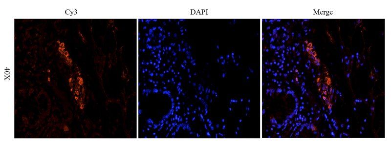 Snail Rabbit Polyclonal Antibody