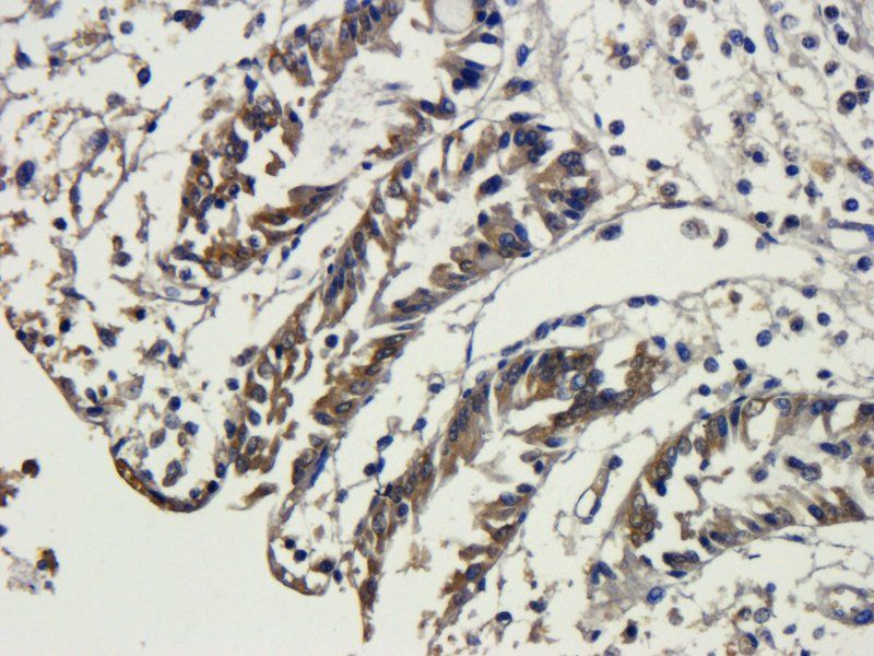 Snail Rabbit Polyclonal Antibody