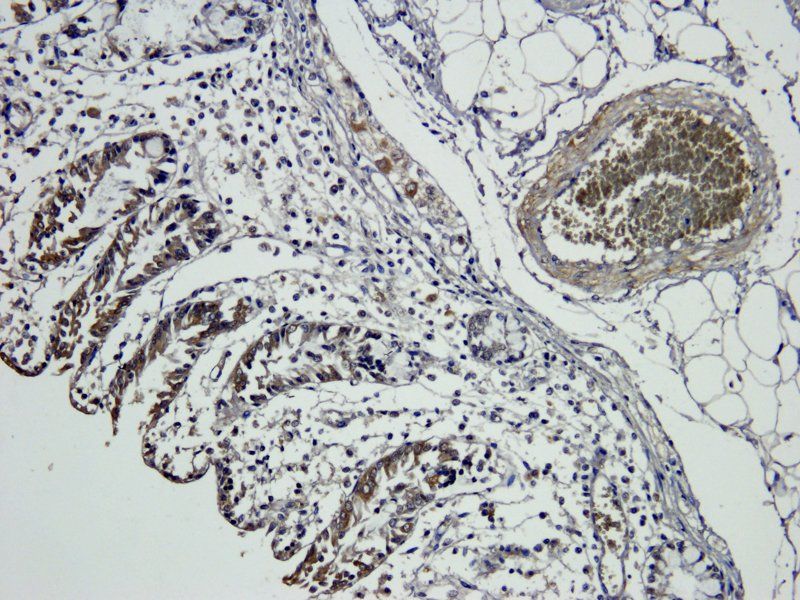 Snail Rabbit Polyclonal Antibody