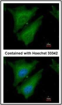 SOCS4 Rabbit Polyclonal Antibody