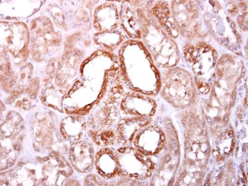 SOCS4 Rabbit Polyclonal Antibody