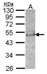 SOCS4 Rabbit Polyclonal Antibody