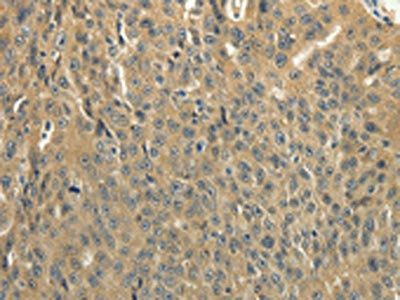 SOCS5 Antibody