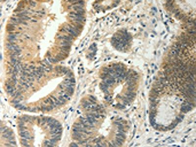 SOCS5 Antibody