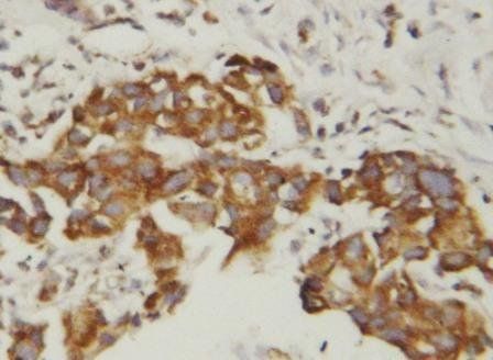 Superoxide Dismutase 1/SOD1 Rabbit Polyclonal Antibody