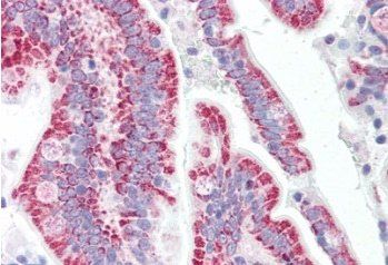 SON Antibody