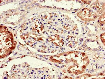 SORD Antibody