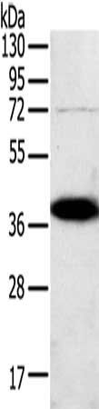 SPARC Antibody