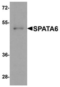 SPATA6 Rabbit Polyclonal Antibody