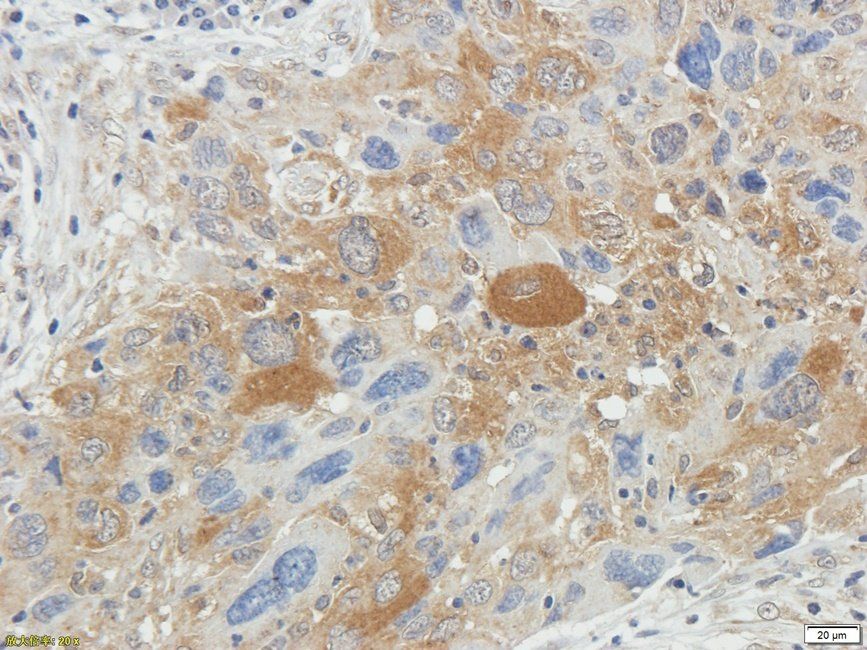 SPC18 Rabbit Polyclonal Antibody