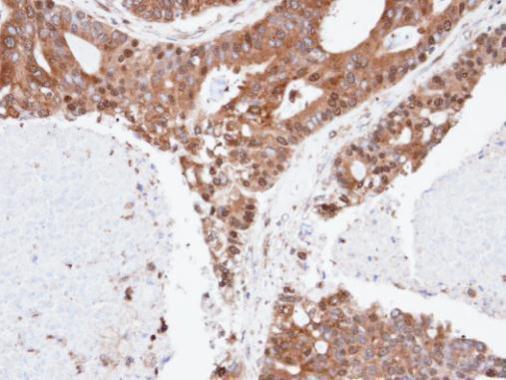SPFH2 Rabbit Polyclonal Antibody