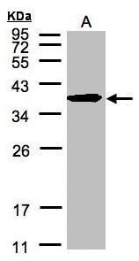 SPFH2 Rabbit Polyclonal Antibody