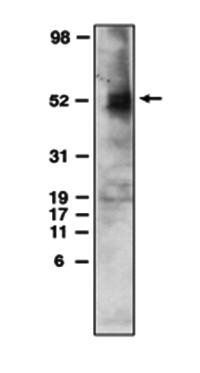 Mouse anti Human Sphingosine 1 Phosphate 4 Receptor (CT) (EDG6) Antibody