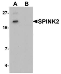 SPINK2 Rabbit Polyclonal Antibody
